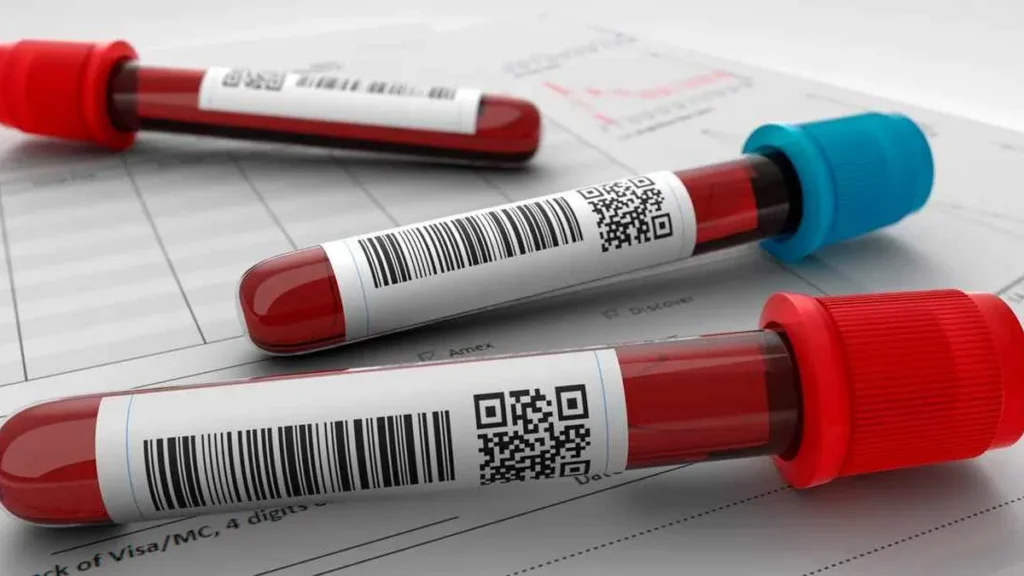 Imagem exame de sangue do artigo Especialista destaca avanços científicos na prevenção do câncer